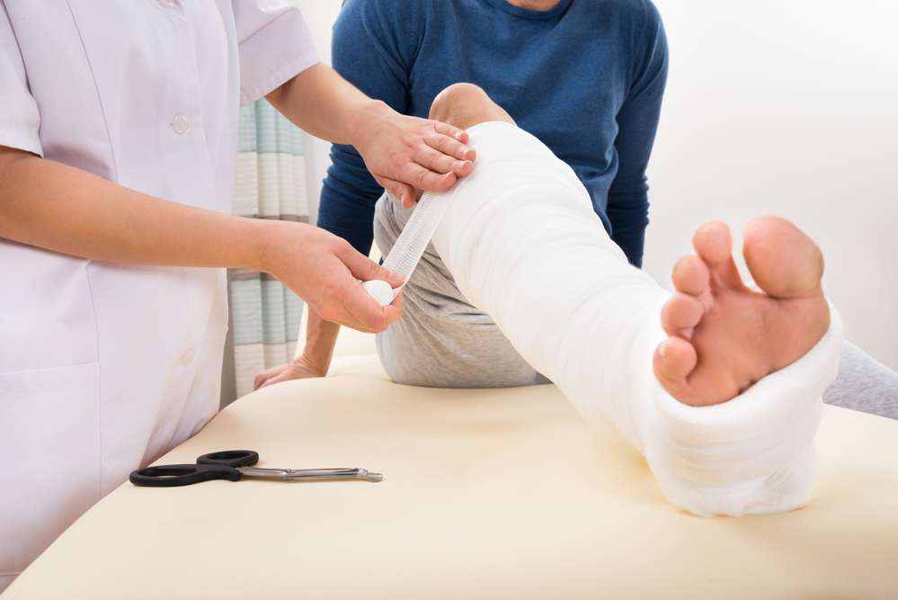 praying for healing of broken bones while a doctor places a cast on leg